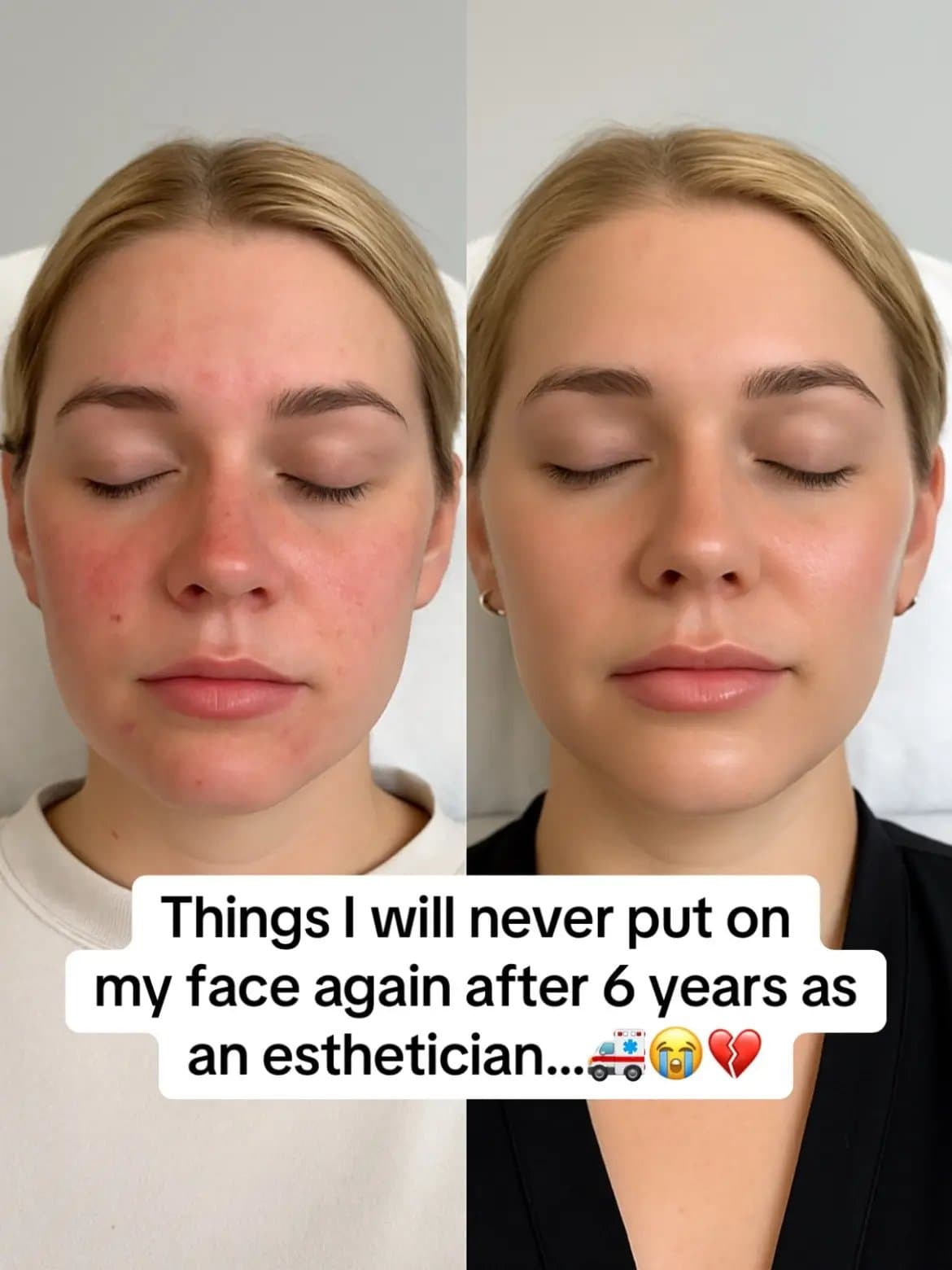 All of these 💩 products
have nothing to do with real
skincare


0/10 🔴

If you…