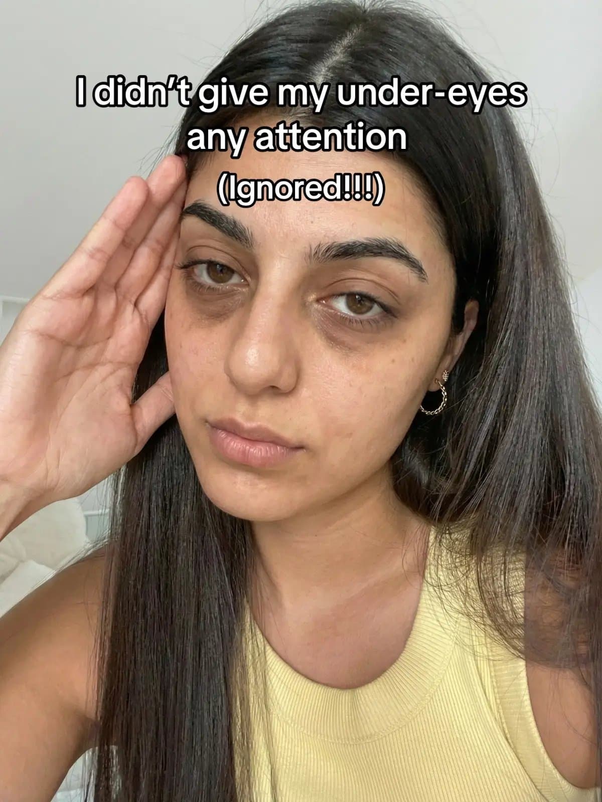 I didn't give my under-eyes
any attention
(Ignored!!!)