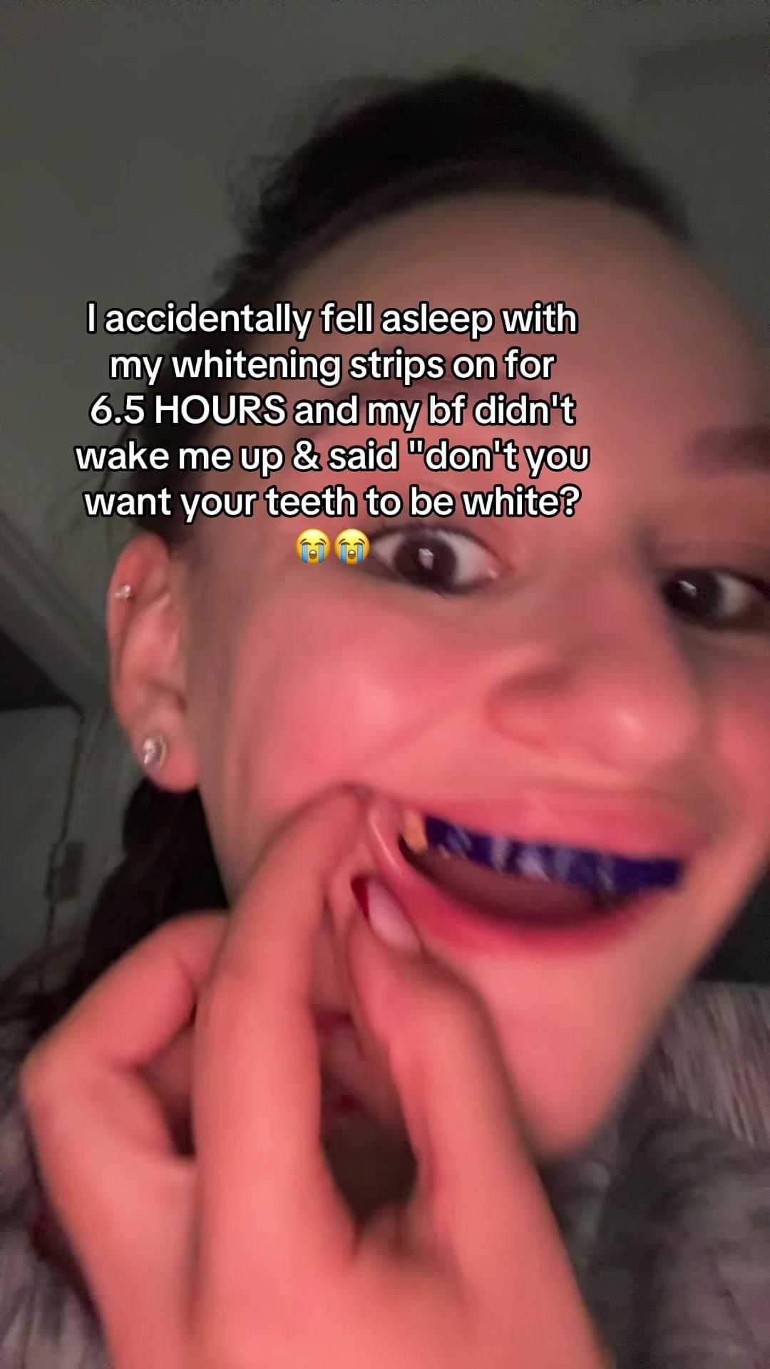 I accidentally fell asleep with
my whitening strips on for
6.5 HOURS and my bf d…
