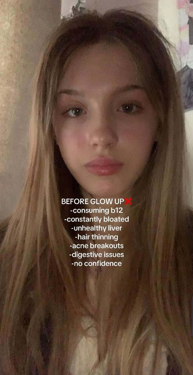 BEFORE GLOW UP ❌
-consuming b12
-constantly bloated
-unhealthy liver
-hair thinn…