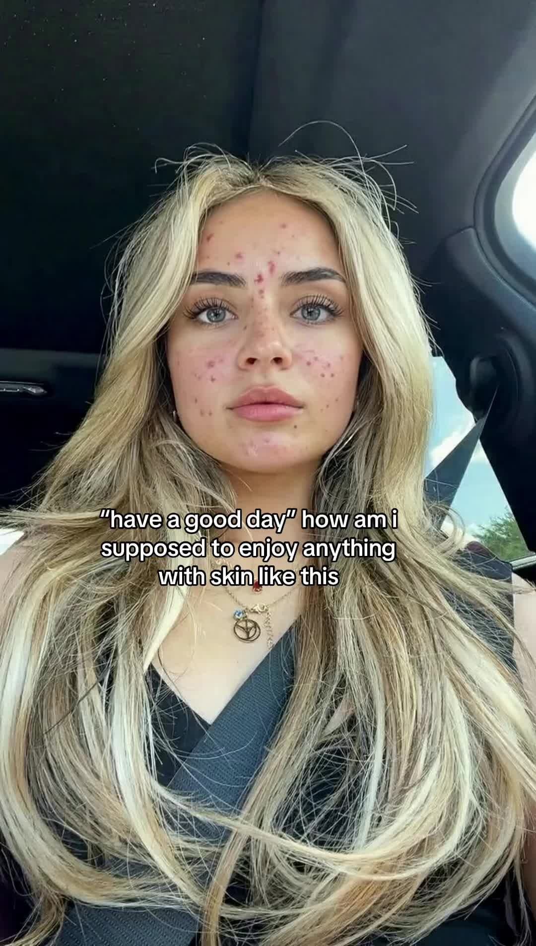 "have a good day" how am i
supposed to enjoy anything
with skin like this