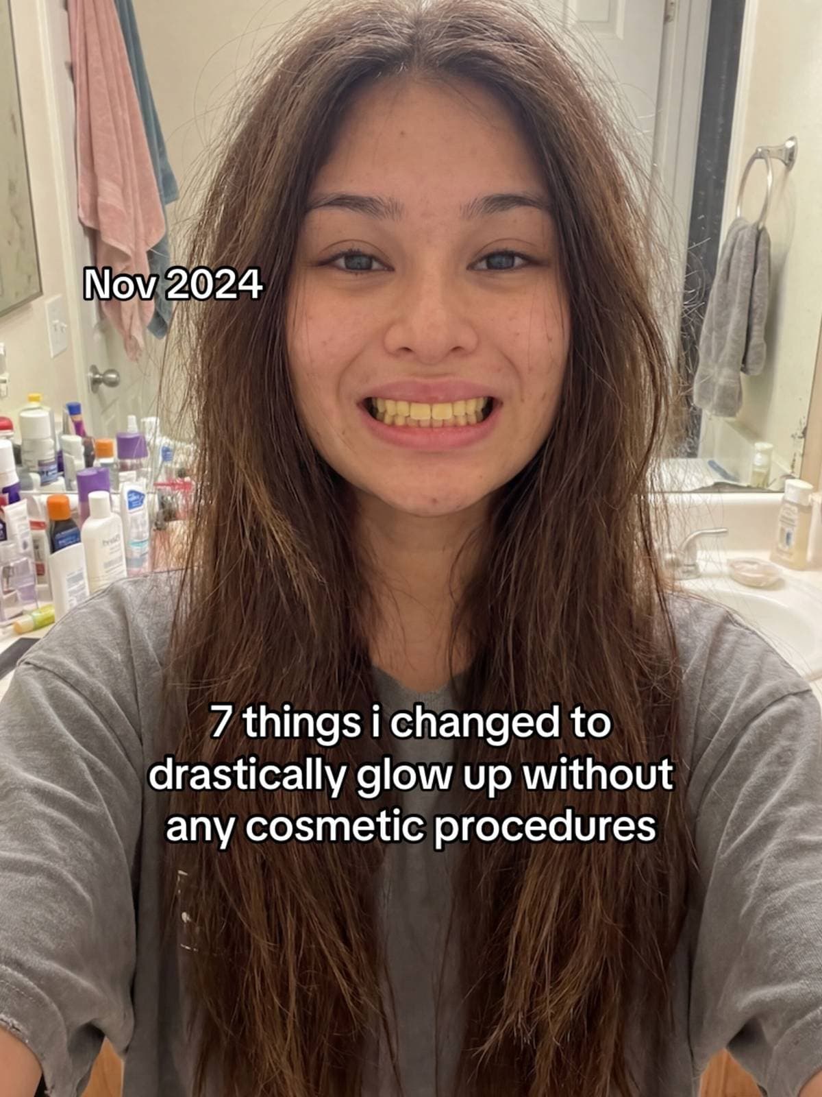 Nov 2024
7 things i changed to
drastically glow up without
any cosmetic procedur…