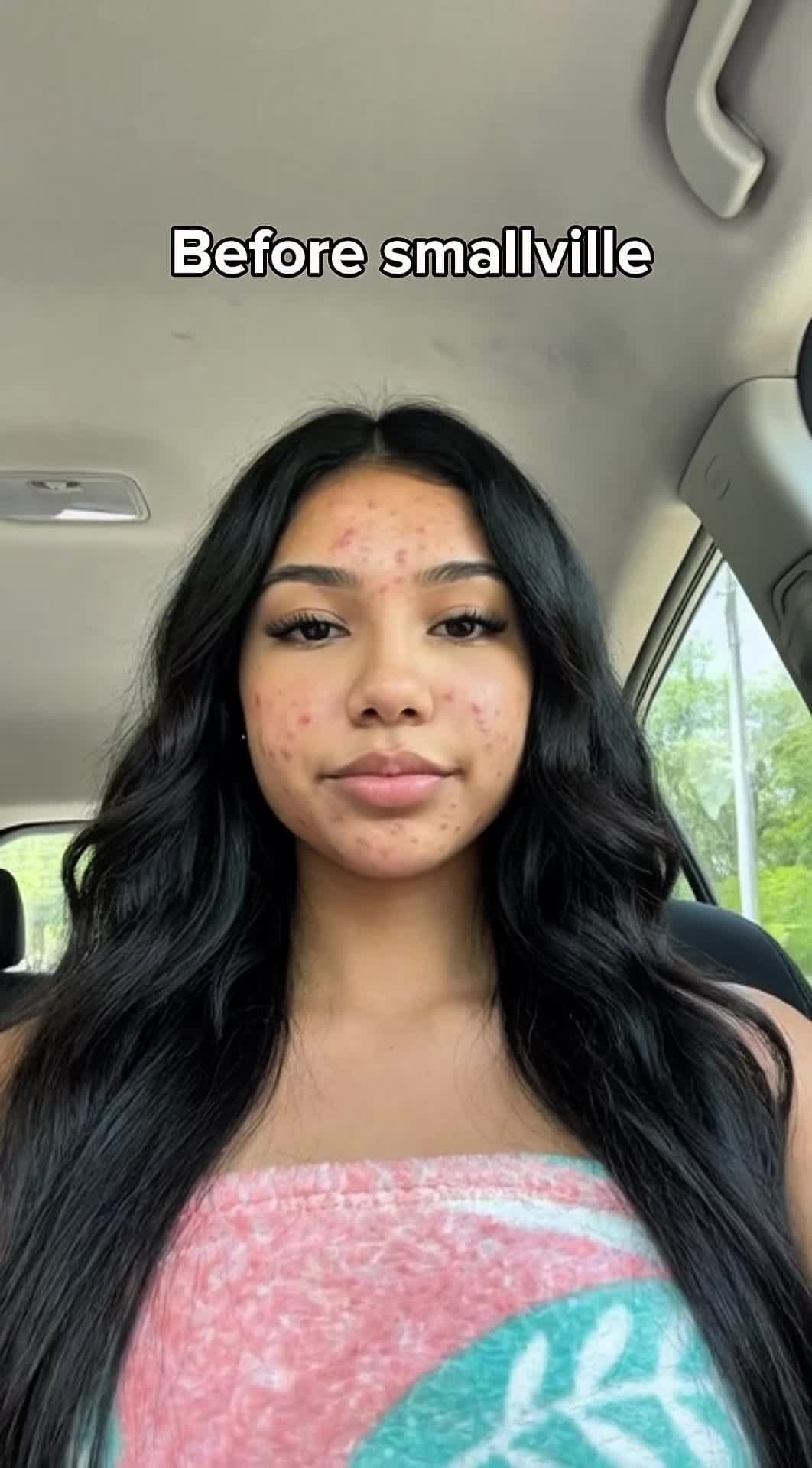 Before smallville
After smallville