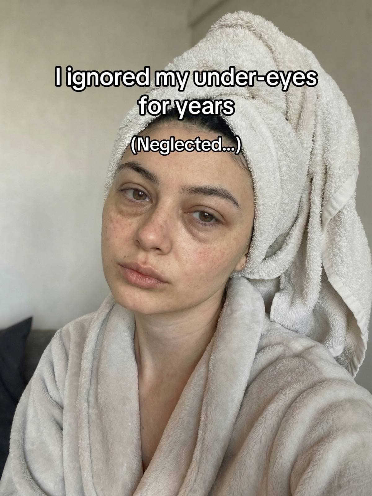 I ignored my under-eyes
for years
(Neglected...)