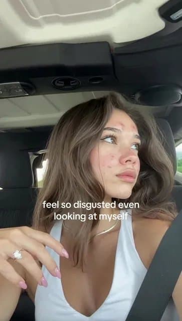 feel so disgusted even
looking at myself