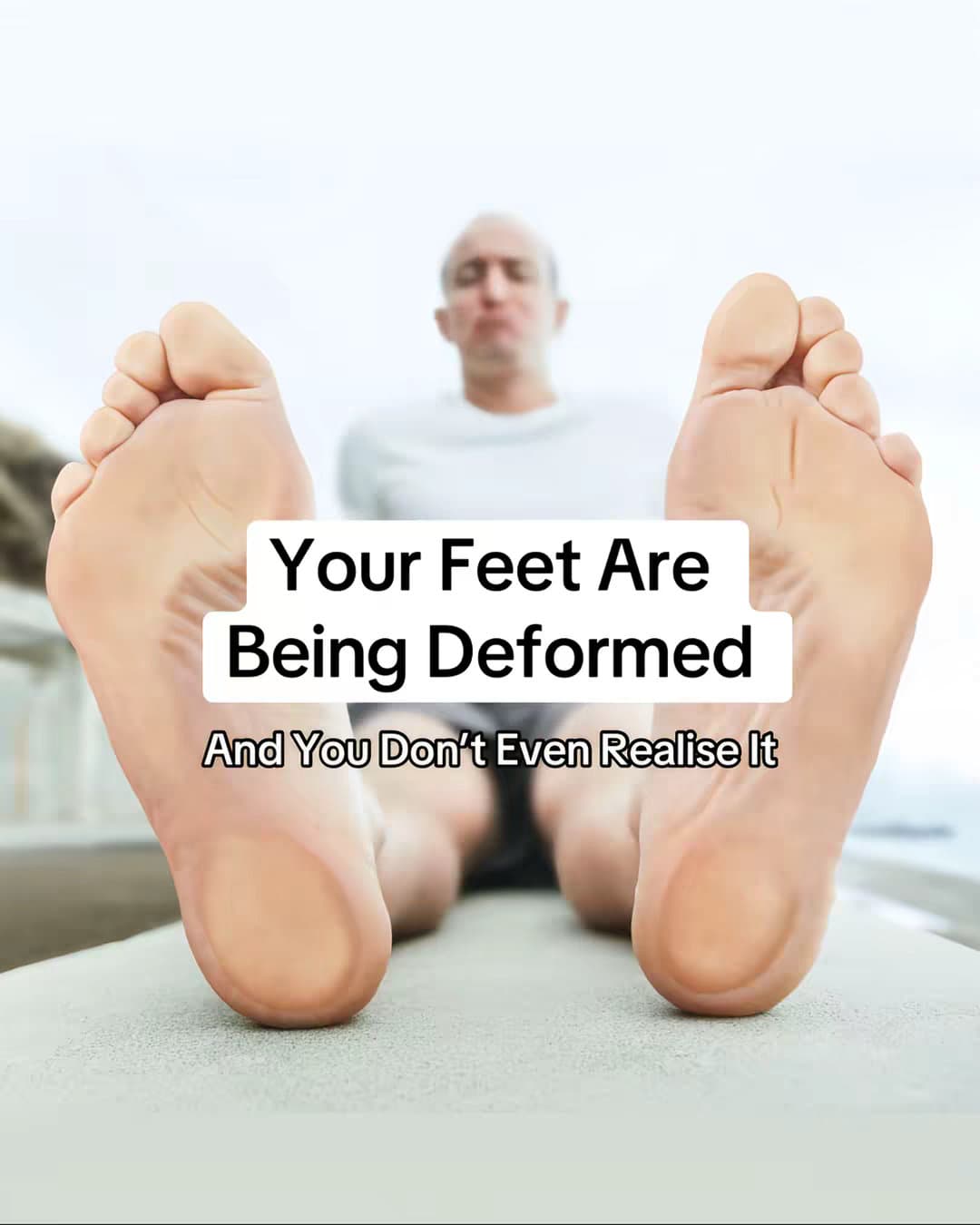 Your Feet Are Being Deformed
And You Don't Even Realise It