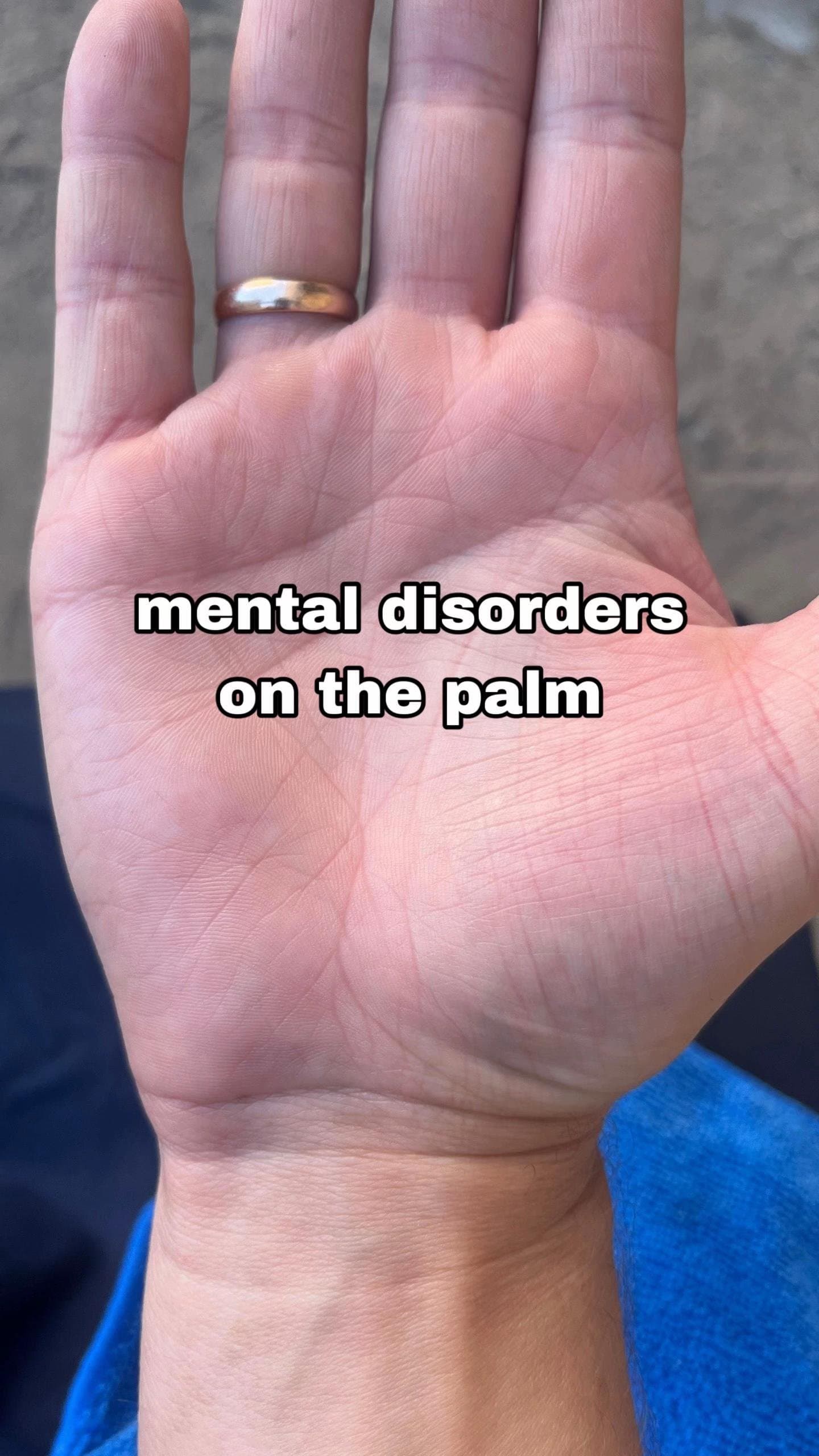 mental disorders
on the palm