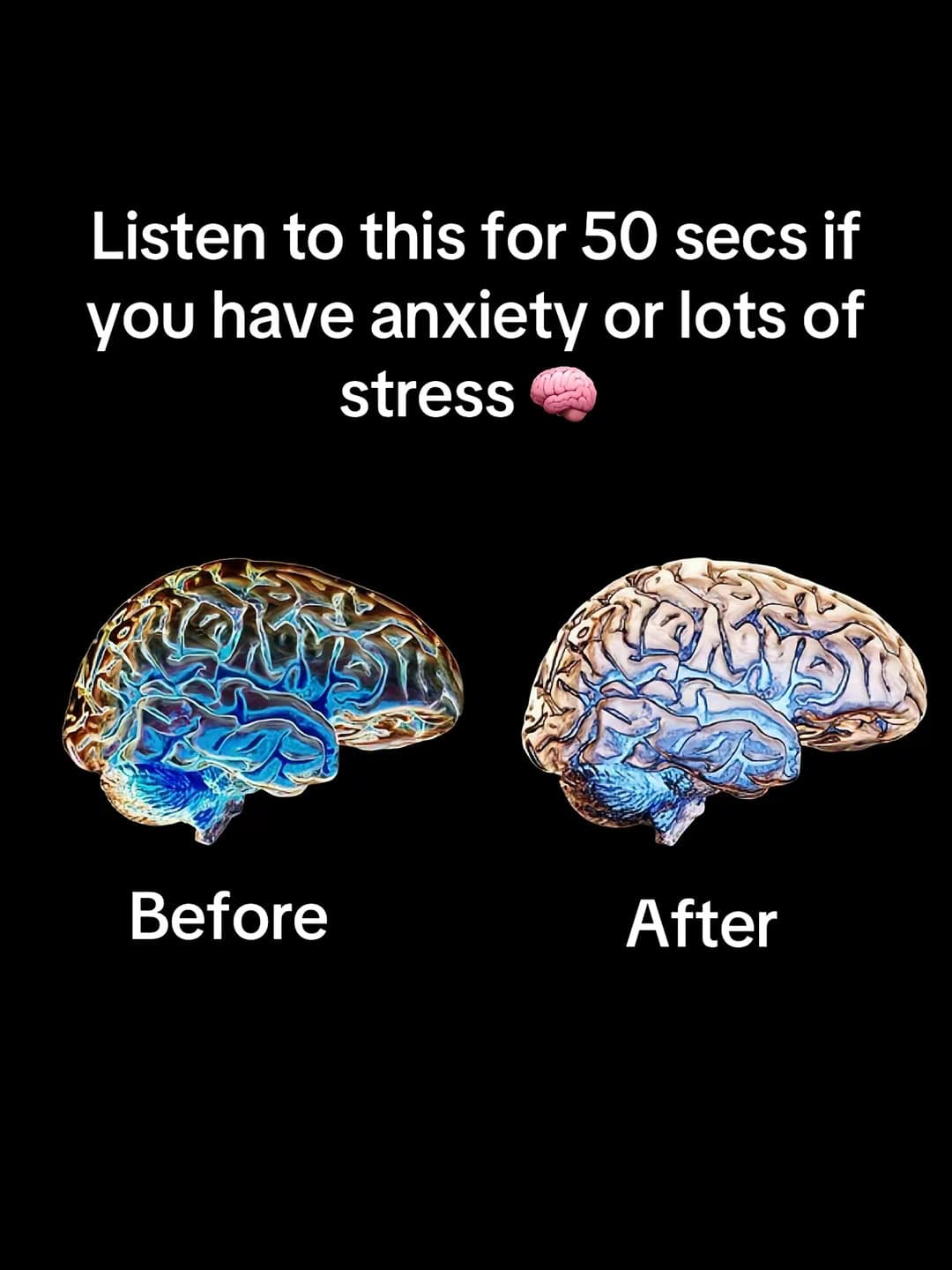 Listen to this for 50 secs if
you have anxiety or lots of
stress 🧠
Before
After…