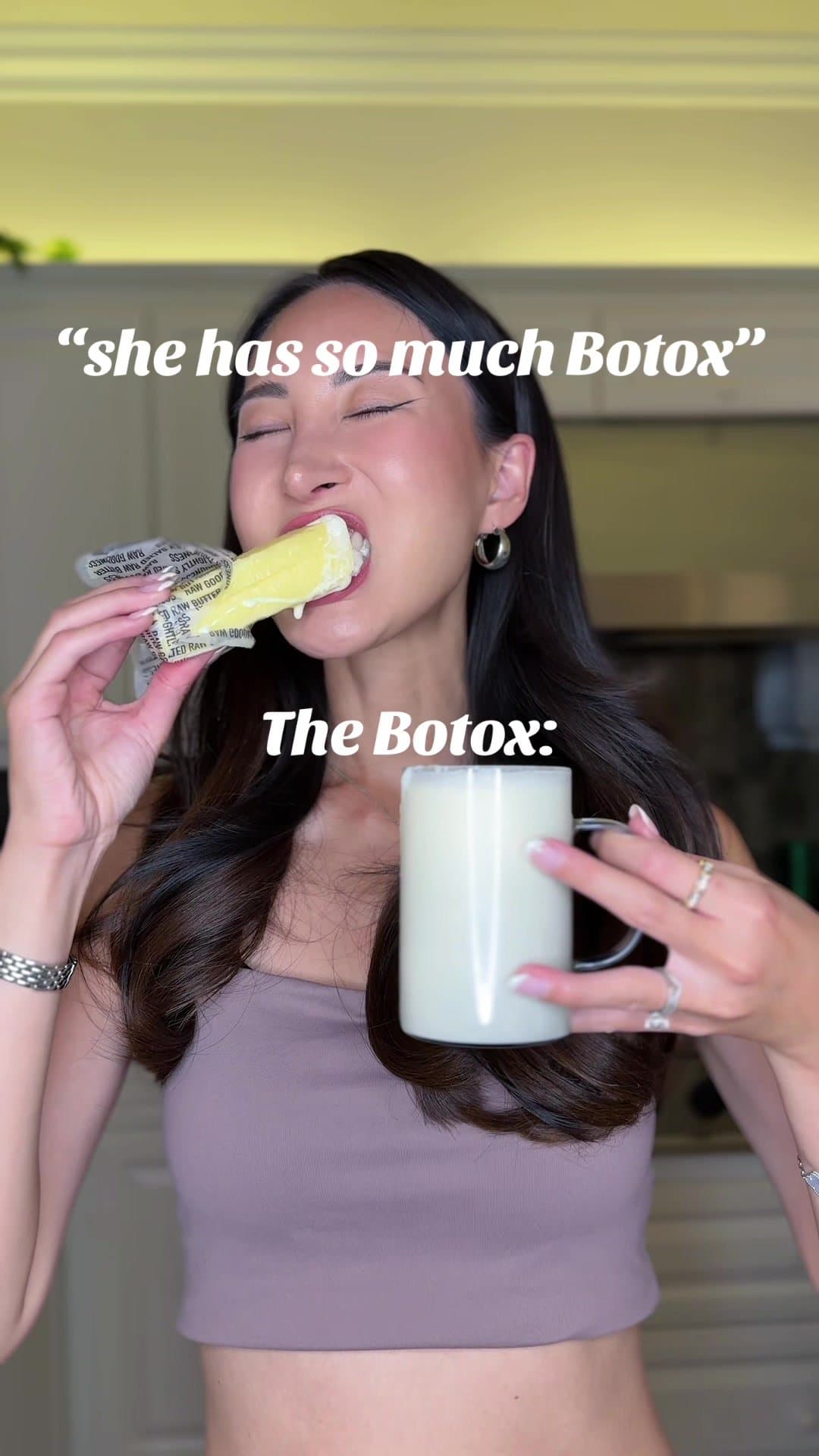 "she has so much Botox"
The Botox: